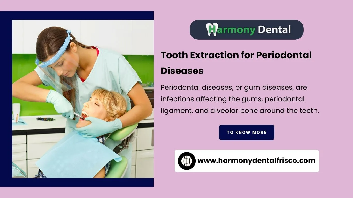 Tooth Extraction for Periodontal Diseases